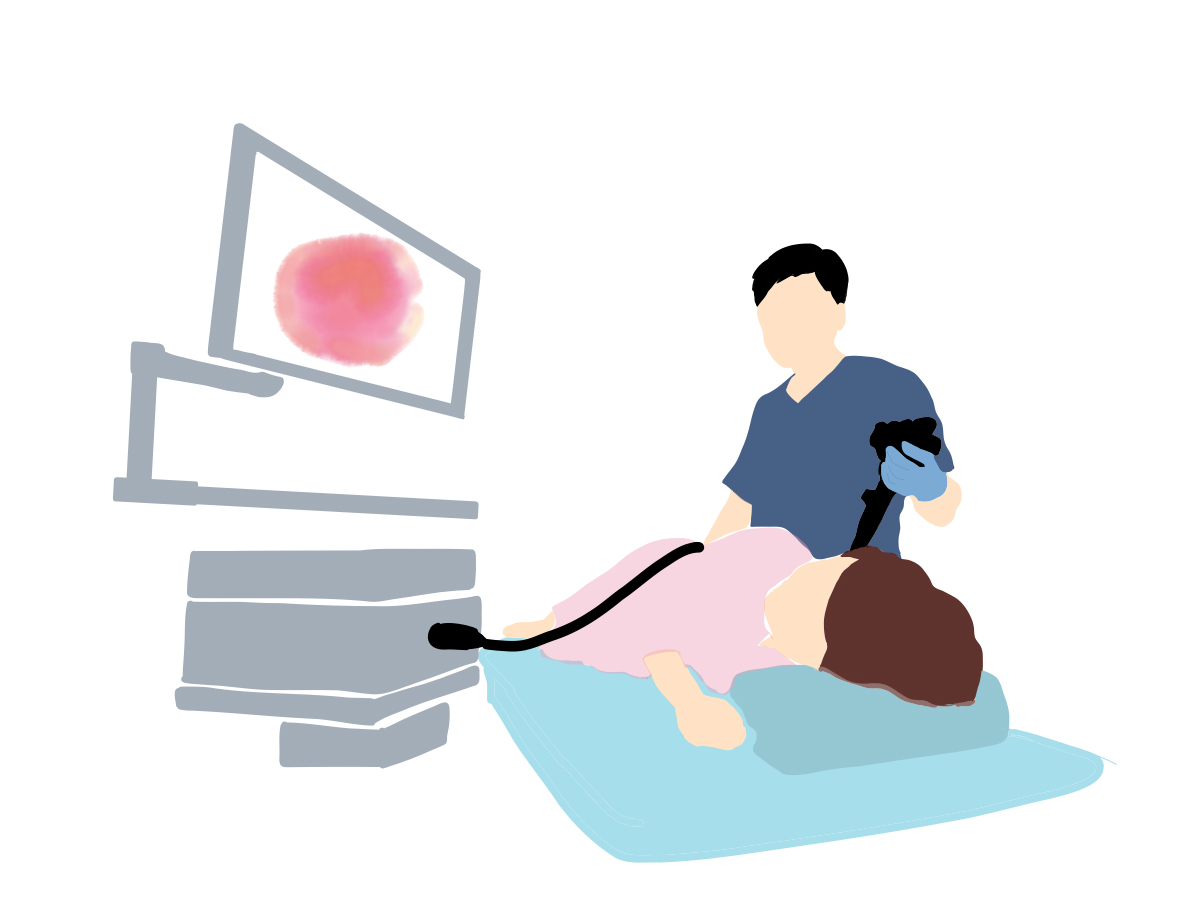 大腸カメラ（内視鏡）検査とは